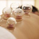 cupping therapy near me